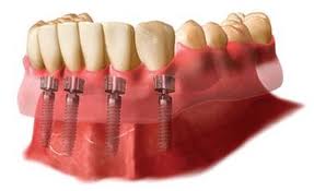 110